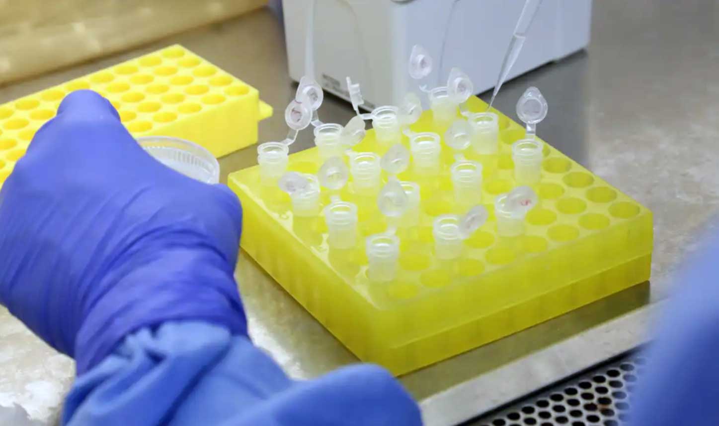 Homem de 42 anos mora na Guatemala e havia sido vacinado